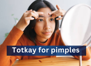 Natural Remedies for Pimples: Your Ultimate Guide to Clear Skin - totkay.com