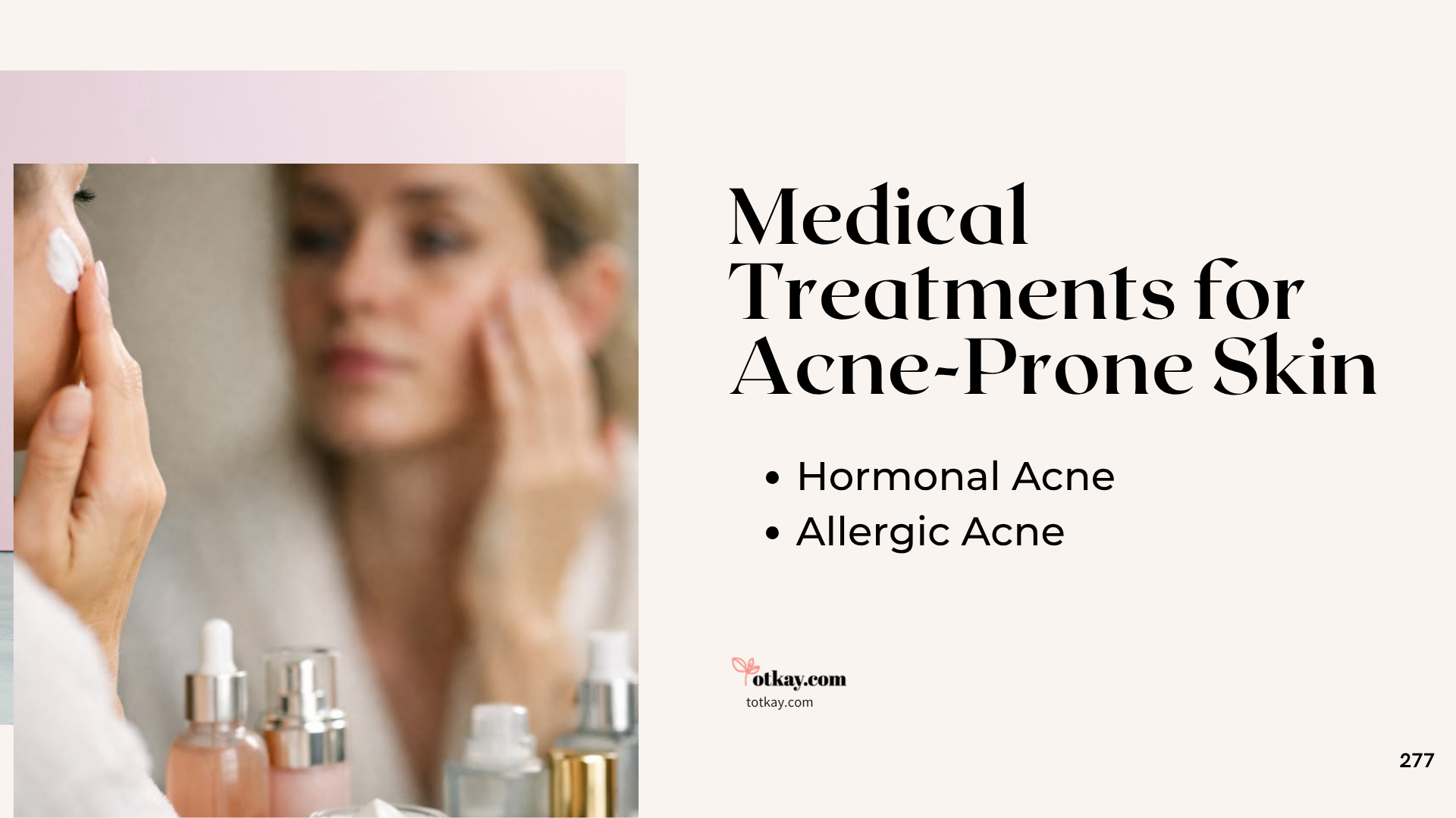 Top 10 Remedies For Acne-Prone Skin That Actually Help 3 An educational skincare graphic detailing clinical Remedies For Acne-Prone Skin, showing a woman applying a topical cream in a mirror with a text list targeting hormonal and allergic acne.