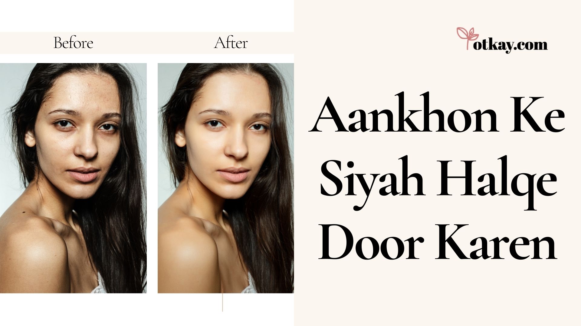 Aankhon Ke Siyah Halqe Door Karen