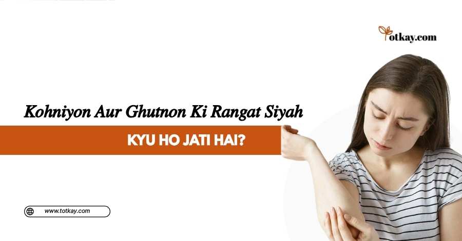 Hath Paon Ki Rangat Saaf Karne Ka Tarika 3 Kohniyon Aur Ghutnon Ki Rangat Siyah Kyu Ho Jati Hai