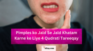 Homepage 25 Pimples ko Jald Se Jald Khatam Karne ke Liye 4 Qudrati Tareeqay