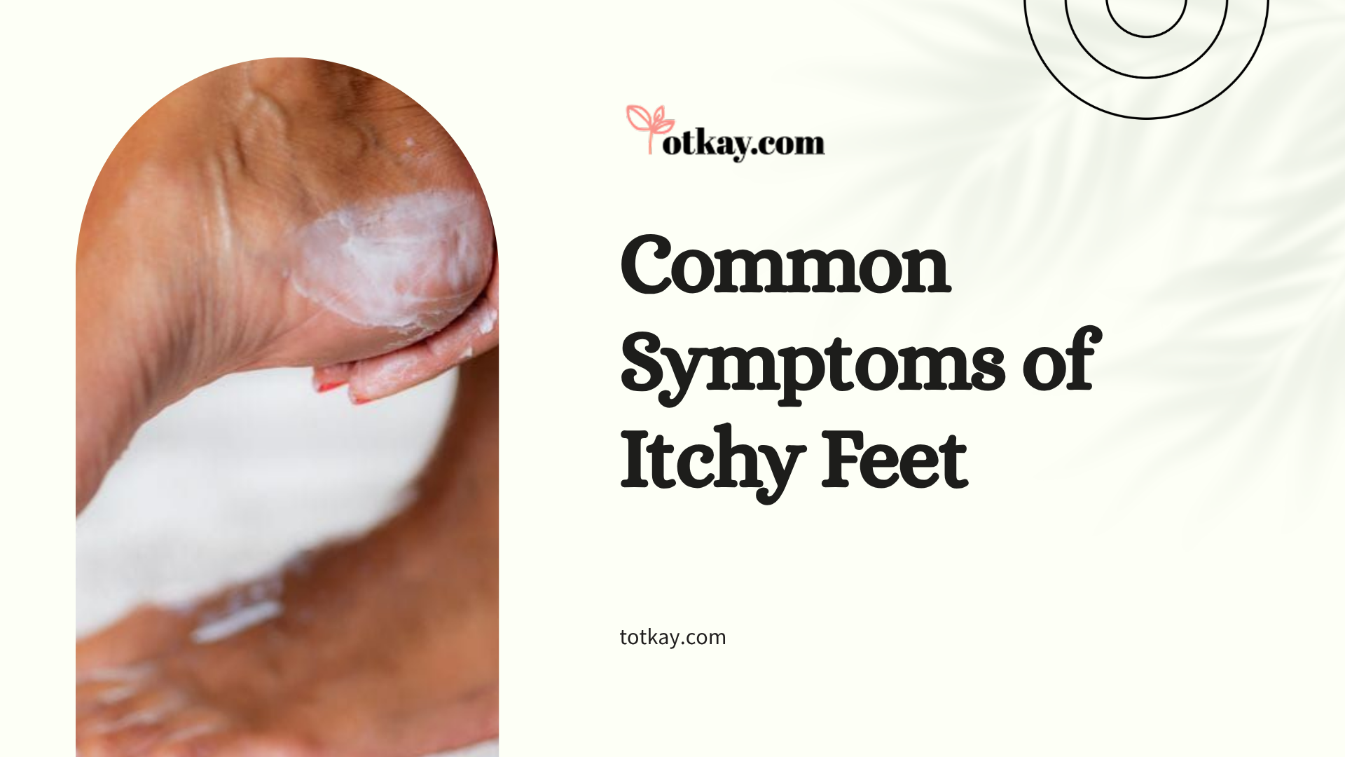 How to Stop Itchy Feet Home Remedies: Causes, Natural Treatments & Prevention 2 An informational graphic about common symptoms of skin irritation, showcasing a person applying white topical cream or thick lotion to their heel as an example of how to stop itchy feet home remedies.