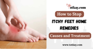 How to Stop Itchy Feet Home Remedies