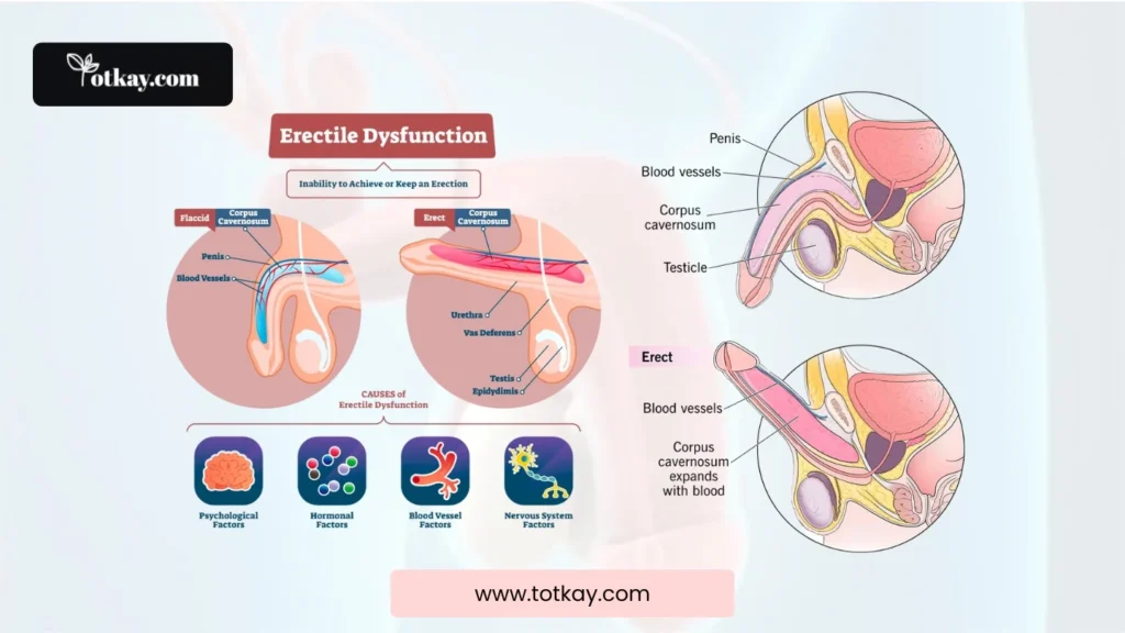 Is There a Natural Remedy for Erectile Dysfunction? A Detailed Guide 3 Erectile Dysfunction