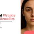 Title graphic reading "Natural Wrinkle Home Remedies for Youthful Skin" from totkay.com. Features a split photo showing a woman's face with wrinkles and fine lines on the left side contrasted with smooth, youthful skin on the right side. Website: www.totkay.com.