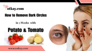 Homepage 17 Remedies for Dark Circles