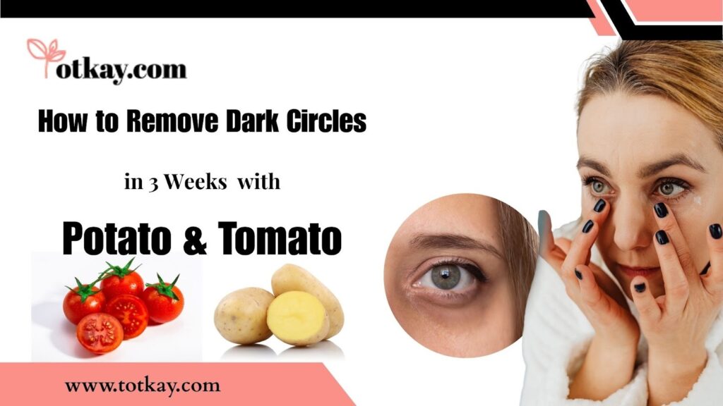 Best Natural Remedies for Dark Circles That Really Work 14 Remedies for Dark Circles
