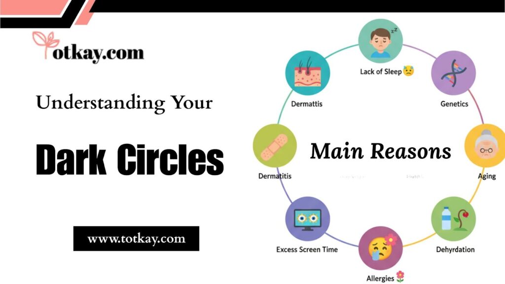 Best Natural Remedies for Dark Circles That Really Work 2 image 1