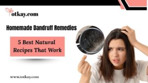 Homemade Dandruff Remedies