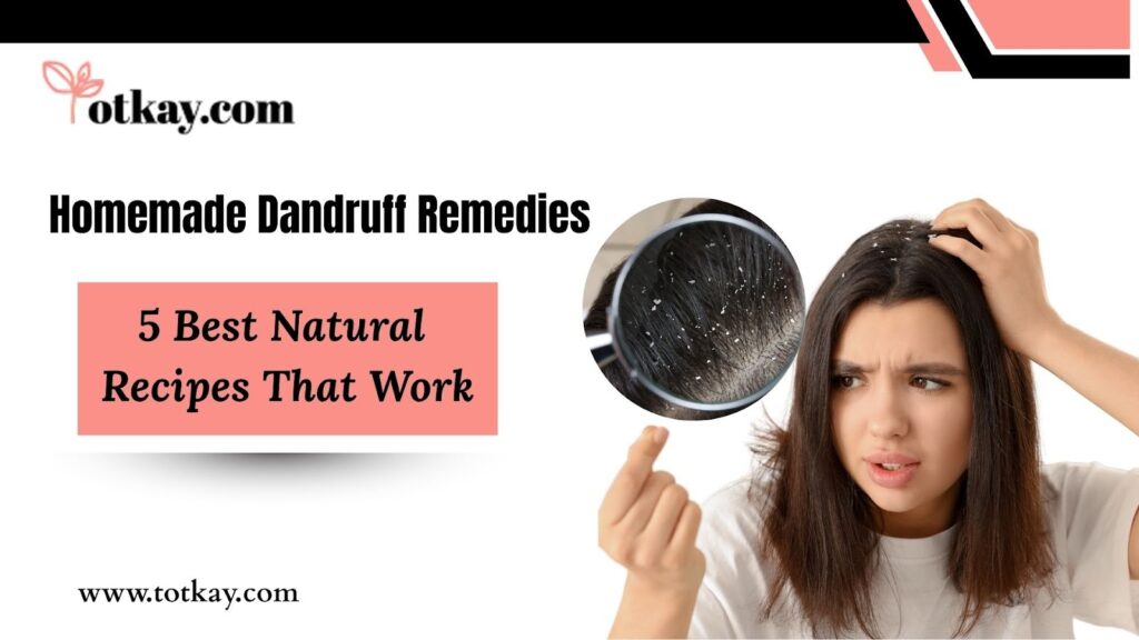 Homemade Dandruff Remedies