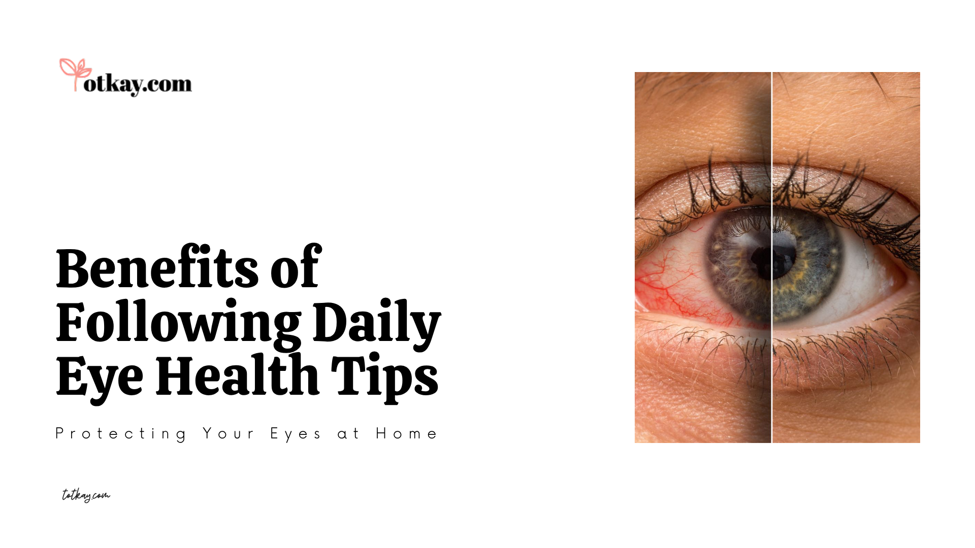 An informative graphic showcasing the benefits of following daily Eye Health Tips, featuring a split-screen close-up comparison of a bloodshot, irritated eye next to a clear, healthy gray eye.