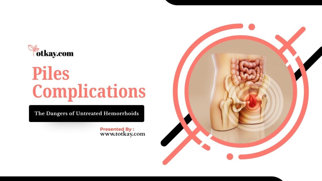 Piles Complications: The Dangers of Untreated Hemorrhoids