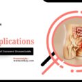 Piles Complications: The Dangers of Untreated Hemorrhoids