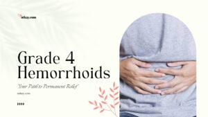 Learn what irreducible prolapse means for your health. Discover effective symptom management strategies and surgical treatments for Grade 4 hemorrhoids.