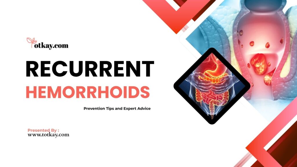 Recurrent Hemorrhoids