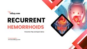 Recurrent Hemorrhoids