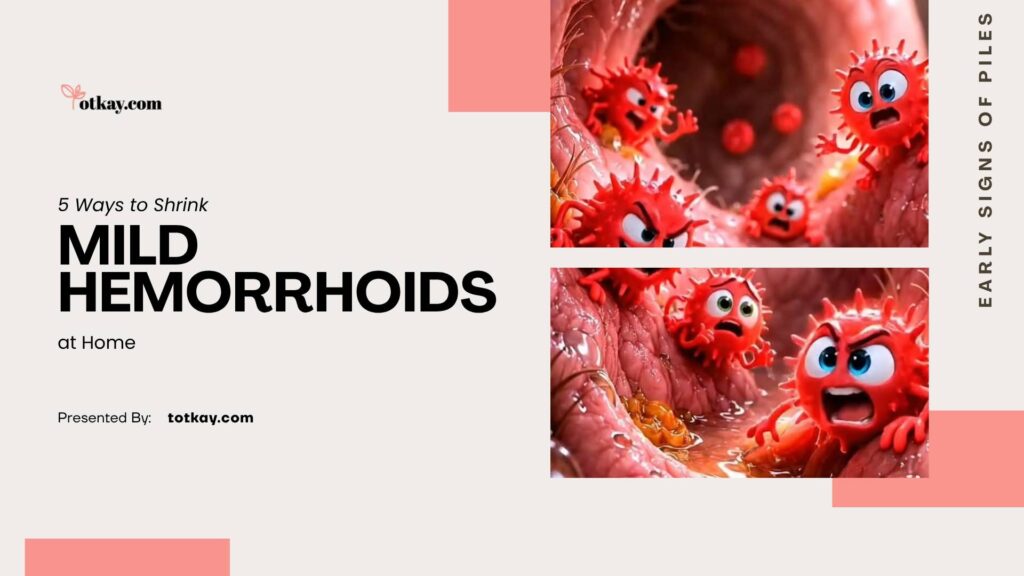 Mild Hemorrhoids