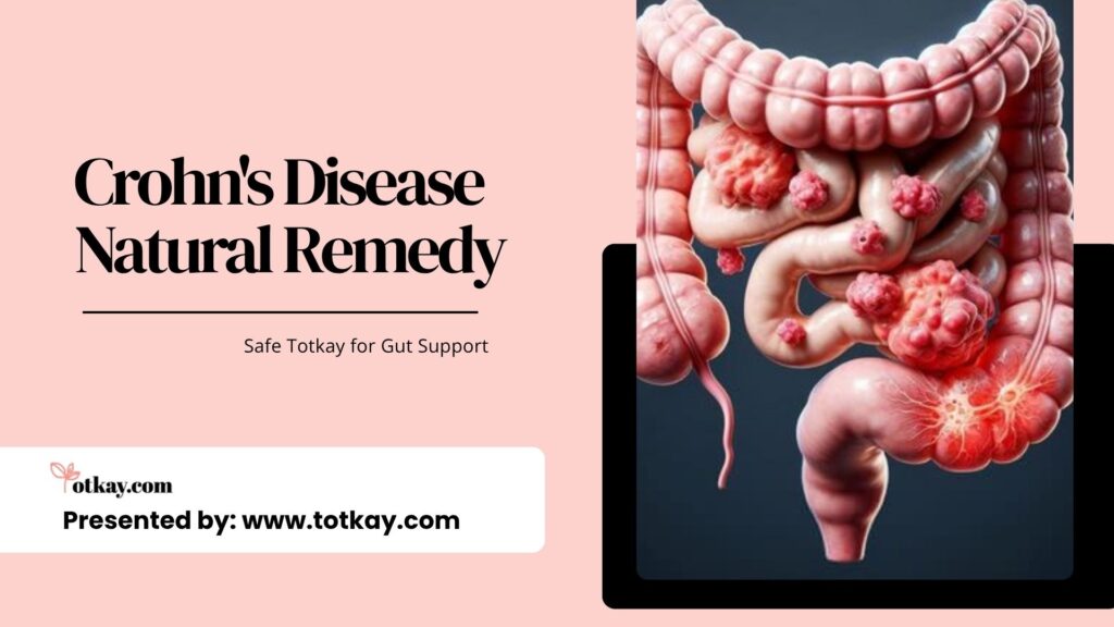 Crohn's Disease Natural Remedy